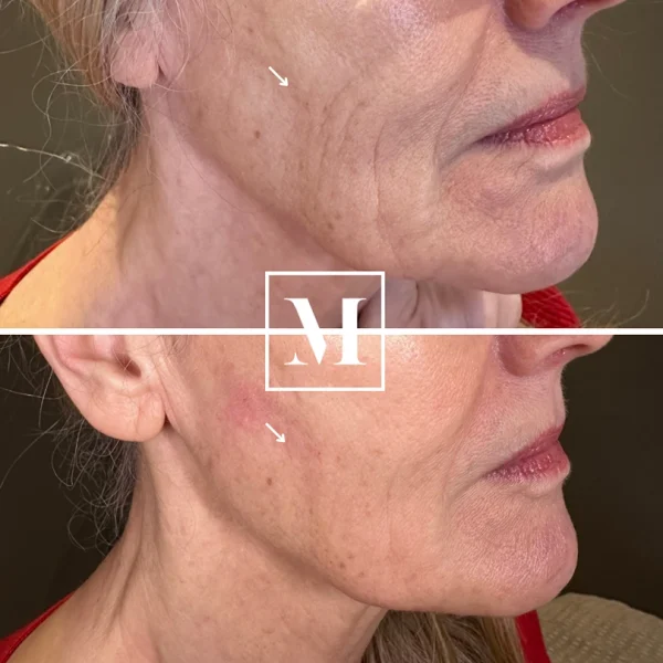 Before and after skin treatment.