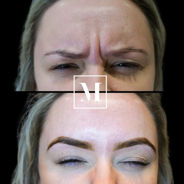 Before and after eyebrow microblading comparison.