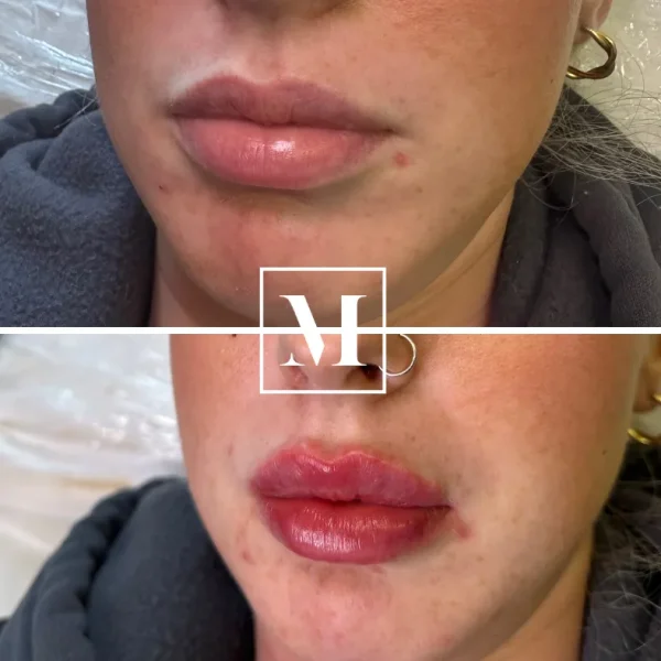Before and after lip color application.